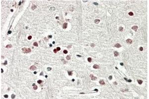 AP20177PU-N SOX3 Antibody staining of paraffin embedded Human Cerebral Cortex at 3. (SOX3 antibody  (C-Term))