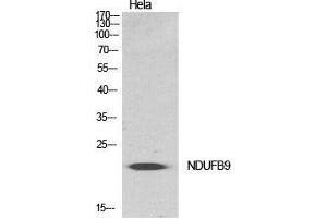 Western Blot (WB) analysis of specific cells using NDUFB9 Polyclonal Antibody. (NDUFB9 antibody  (Internal Region))