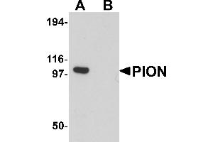 Western Blotting (WB) image for anti-Pigeon Homolog (PION) (C-Term) antibody (ABIN1030587) (GSAP antibody  (C-Term))