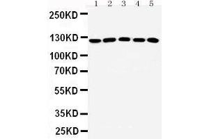 Western Blotting (WB) image for anti-Suppression of Tumorigenicity 5 (ST5) (AA 571-586), (Middle Region) antibody (ABIN3042548) (ST5 antibody  (Middle Region))