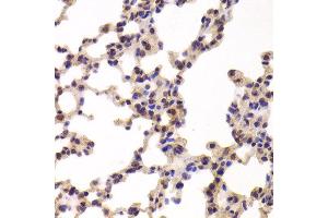 Immunohistochemistry of paraffin-embedded Mouse lung using PYGL antibody at dilution of 1:100 (x400 lens). (PYGL antibody)