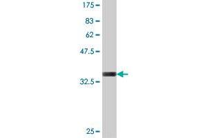 Western Blot detection against Immunogen (36. (POT1 antibody  (AA 1-95))