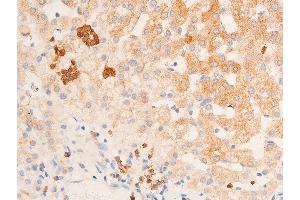 Immunohistochemistry (IHC) image for anti-Checkpoint Kinase 1 (CHEK1) (pSer317) antibody (ABIN6255201)