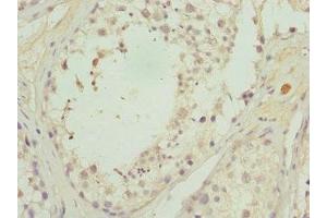 Immunohistochemistry of paraffin-embedded human testis tissue using ABIN7146346 at dilution of 1:100 (CALCOCO1 antibody  (AA 462-691))