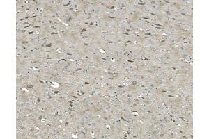 IHC analysis of ULK1 using anti-ULK1 antibody (ABIN7602755). (ULK1 antibody  (C-Term))