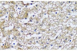 Immunohistochemistry of paraffin-embedded Human liver using NQO2 Polyclonal Antibody at dilution of 1:100 (40x lens). (NQO2 antibody)