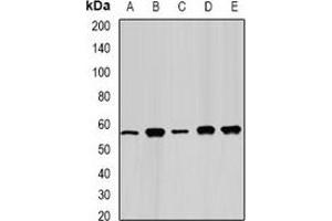 Western blot analysis of FAAH expression in Jurkat (A), Hela (B), mouse kidney (C), PC12 (D), COS7 (E) whole cell lysates. (FAAH antibody)