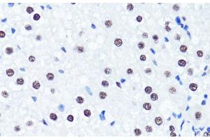 Immunohistochemistry of paraffin-embedded Rat liver using Symmetric DiMethyl-Histone H3-R2 Polyclonal Antibody at dilution of 1:100 (40x lens). (Histone 3 antibody  (H3R2me2s))