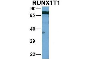 Host:  Rabbit  Target Name:  WT1  Sample Type:  721_B  Antibody Dilution:  1. (RUNX1T1 antibody  (Middle Region))