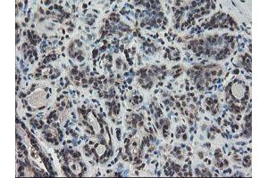 Immunohistochemical staining of paraffin-embedded Human breast tissue using anti-TDO2 mouse monoclonal antibody.