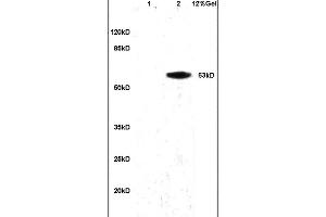 Lane 1: mouse brain lysates Lane 2: human colon carcinoma lysates probed with Anti alpha Actinin PGRN/Granulin Polyclonal Antibody, Unconjugated (ABIN728668) at 1:200 in 4 °C.