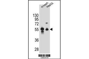 Western blot analysis in mouse heart tissue and HepG2 cell line lysates (35ug/lane). (DPEP3 antibody  (C-Term))