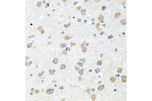 Immunohistochemistry of paraffin-embedded mouse brain using CHD1 antibody (ABIN5975217) at dilution of 1/100 (40x lens). (CHD1 antibody)