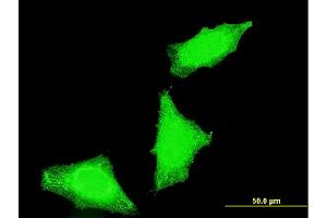 Immunofluorescence of monoclonal antibody to PPP1R2P3 on HeLa cell. (PPP1R2P3 antibody  (AA 1-205))