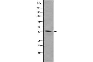 Western blot analysis of WNT16 using Jurkat whole cell lysates (WNT16 antibody  (C-Term))