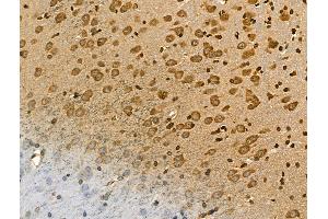 ABIN7094432 and ABIN7098480 at 1/100 staining Rat brain tissue by IHC-P. (ALDH1L1 antibody  (C-Term))