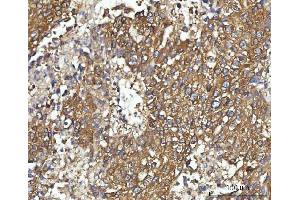 IHC analysis of CBR1 using anti-CBR1 antibody (ABIN7600015). (CBR1 antibody  (AA 14-262))