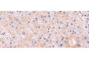 Immunohistochemistry of paraffin-embedded Human tonsil tissue using KANSL1L Polyclonal Antibody at dilution of 1:40(x200)