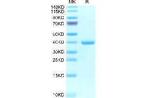 Human EREG on Tris-Bis PAGE under reduced condition. (Epiregulin Protein (EREG) (AA 63-108) (Fc Tag))