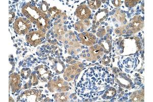 DCXR antibody was used for immunohistochemistry at a concentration of 4-8 ug/ml to stain Epithelial cells of renal tubule (arrows) in Human Kidney.