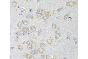 Immunohistochemistry of paraffin-embedded Rat brain using CHMP1B Polyclonal Antibody at dilution of 1:100 (40x lens).