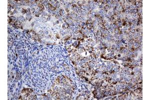 Image no. 1 for anti-NADH Dehydrogenase (Ubiquinone) 1 beta Subcomplex, 10, 22kDa (NDUFB10) antibody (ABIN1499672) (NDUFB10 antibody)
