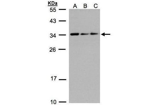 SARNP antibody