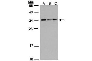 WB Image Sample(30 ug whole cell lysate) A:293T B:A431, C:H1299 12% SDS PAGE antibody diluted at 1:1000