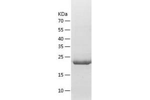Western Blotting (WB) image for Isopentenyl-Diphosphate delta Isomerase 1 (IDI1) (AA 1-228) protein (His tag) (ABIN7123641) (IDI1 Protein (AA 1-228) (His tag))
