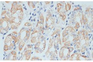 Immunohistochemistry of paraffin-embedded Human stomach using ADAM9 Polyclonal Antibody at dilution of 1:100 (40x lens). (ADAM9 antibody)