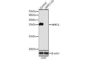 Western blot analysis of extracts from normal (control) and HPRT1 knockout (KO) 293T cells, using HPRT1 antibody (ABIN6132283, ABIN6141970, ABIN6141971 and ABIN7101782) at 1:1000 dilution. (HPRT1 antibody  (AA 1-218))
