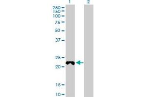 Western Blot analysis of COX4NB expression in transfected 293T cell line by COX4NB MaxPab polyclonal antibody. (COX4NB antibody  (AA 1-210))