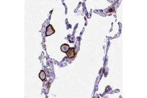 Immunohistochemical staining (Formalin-fixed paraffin-embedded sections) of human lung with SPN polyclonal antibody  shows strong membranous positivity in a subset of macrophages and pneumocytes.