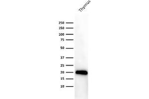 Western Blot Analysis of human Thymus lysate using Purified CD3e Mouse Monoclonal Antibody (PC3/188A).