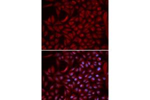 Immunofluorescence analysis of U2OS cells using CUL5 antibody. (Cullin 5 antibody  (AA 1-300))