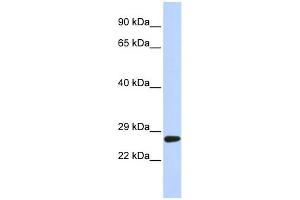 WB Suggested Anti-SETD4 Antibody Titration:  0. (SETD4 antibody  (C-Term))