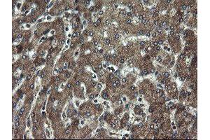 Immunohistochemical staining of paraffin-embedded Human liver tissue using anti-DOK7 mouse monoclonal antibody.