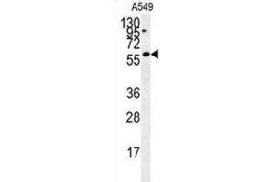 Western Blotting (WB) image for anti-PARP1 Binding Protein (PARPBP) antibody (ABIN2995516) (PARPBP antibody)