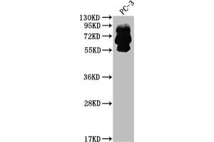 Western Blot Positive WB detected in: PC-3 whole cell lysate All lanes: PCSK9 antibody at 1:2000 Secondary Goat polyclonal to rabbit IgG at 1/50000 dilution Predicted band size: 75, 21 kDa Observed band size: 60, 75 kDa (Recombinant PCSK9 antibody)