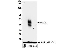 Western Blotting (WB) image for anti-Killer Cell Lectin-Like Receptor Subfamily C, Member 1 (KLRC1) (AA 1-50) antibody (ABIN7795693)
