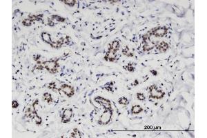 Immunoperoxidase of monoclonal antibody to C4orf43 on formalin-fixed paraffin-embedded human breast.