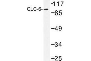 Image no. 1 for anti-Chloride Channel, Voltage-Sensitive 6 (CLCN6) antibody (ABIN317827) (CLCN6 antibody)