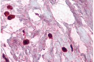 Human Breast, Mast Cells (formalin-fixed, paraffin-embedded) stained with TPSAB1 antibody ABIN337075 at 2. (TPSAB1 antibody)