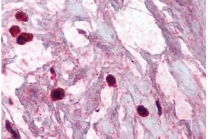 Human Breast, Mast Cells (formalin-fixed, paraffin-embedded) stained with TPSAB1 antibody ABIN337075 at 2.
