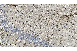 IHC analysis of GFAP using anti-GFAP antibody (ABIN7602675). (GFAP antibody  (AA 93-432))