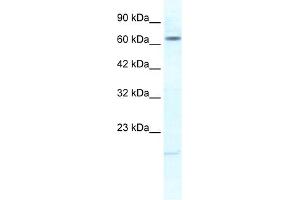 WB Suggested Anti-KCNH6 Antibody Titration:  1. (KCNH6 antibody  (N-Term))