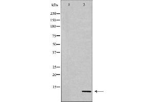 Western blot analysis of Hela whole cell lysates, using Histone H4K20me3 Antibody. (Histone H4 antibody  (3meLys20))