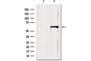 Western blot analysis of extracts from Hela, using CBS Antibody.