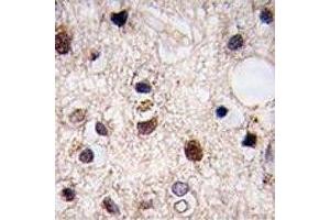IHC analysis of FFPE human brain tissue stained with JMJD3 (Kdm6b antibody  (AA 1-30))