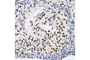 Immunohistochemistry of paraffin-embedded rat ovary using SF3B1 Rabbit mAb (ABIN7270542) at dilution of 1:100 (40x lens). (SF3B1 antibody)